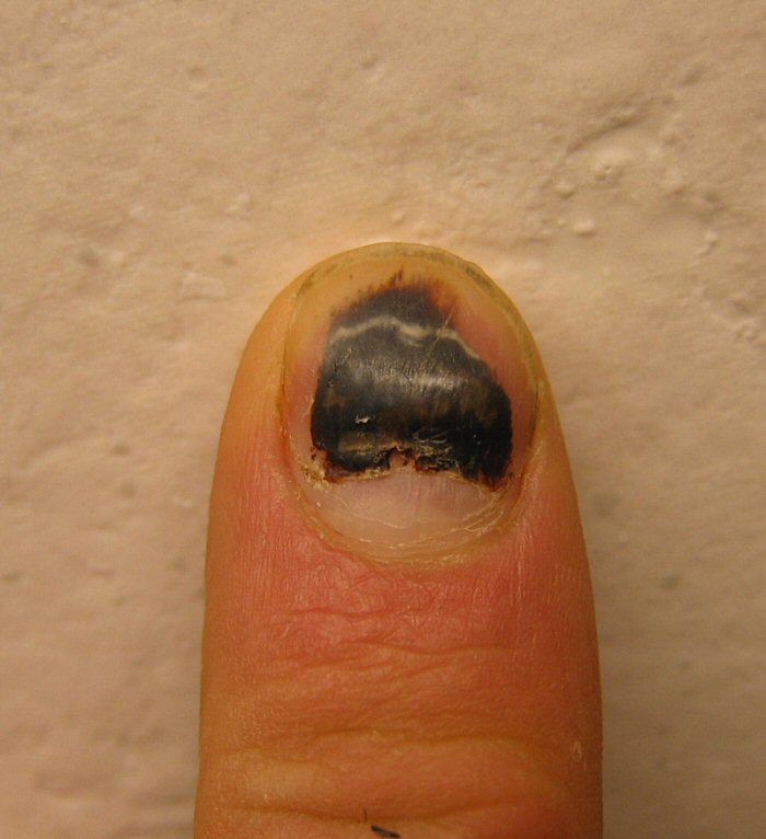 nail_1464.JPG