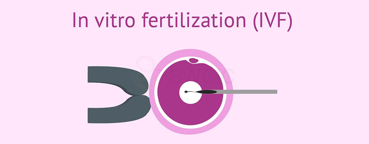 IVF Treatment